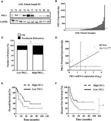Protein Kinase C Epsilon Overexpression Is Associated With Poor Patient Outcomes in AML and Promotes Daunorubicin Resistance Through p-Glycoprotein-Mediated Drug Efflux